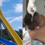 CRIANÇA SOFRE FERIMENTO NA CABEÇA EM TOBOGÃ DE PARQUE AQUÁTICO E PAI DENUNCIA TENTATIVA DE SUBORNO PARA ‘ABAFAR’ CASO