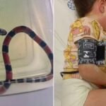 MENINA É PICADA POR COBRA CORAL E SOFRE CHOQUE ANAFILÁTICO: “IRRECONHECÍVEL”, DIZ MÃE