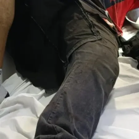 PINTOR É ATACADO COM GOLPES DE FOICE ENQUANTO TRABALHAVA