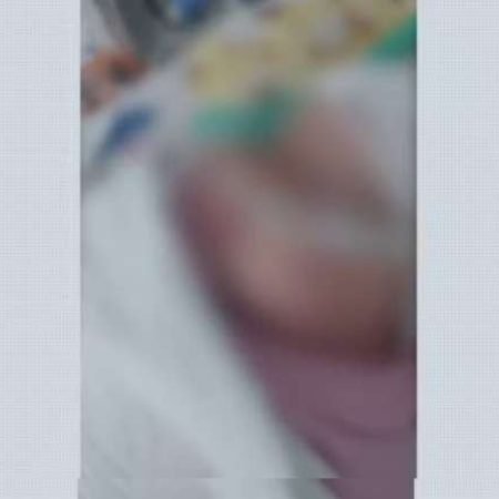 BEBÊ DE TRÊS MESES QUE TEVE OBJETO ESQUECIDO DENTRO DE PULMÃO DURANTE INTUBAÇÃO RECEBE ALTA