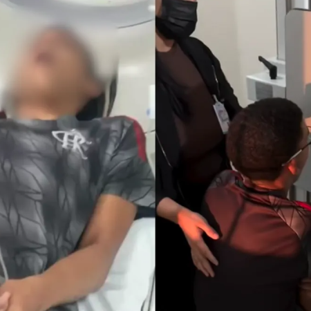 BOCEJAR É PERIGOSO? JOVEM FOI AO HOSPITAL APÓS DESLOCAR MANDÍBULA; ENTENDA O RISCO