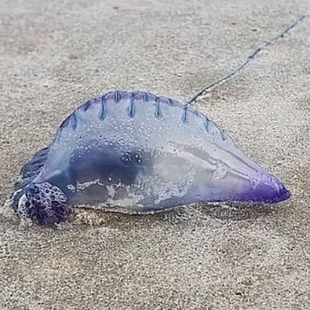 MULHER SOFRE QUEIMADURAS NO ROSTO APÓS SER ATACADA POR CARAVELAS NA PRAIA DO FRANCÊS