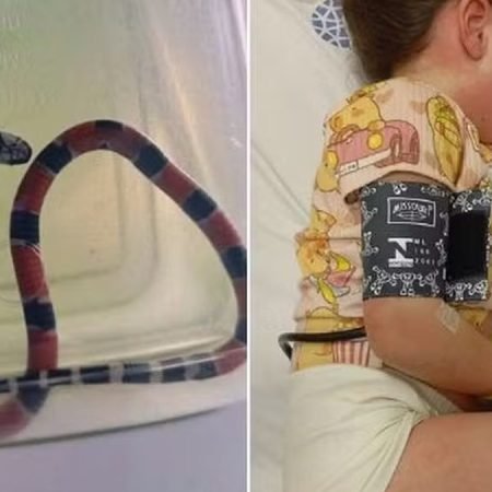 MENINA É PICADA POR COBRA CORAL E SOFRE CHOQUE ANAFILÁTICO: “IRRECONHECÍVEL”, DIZ MÃE