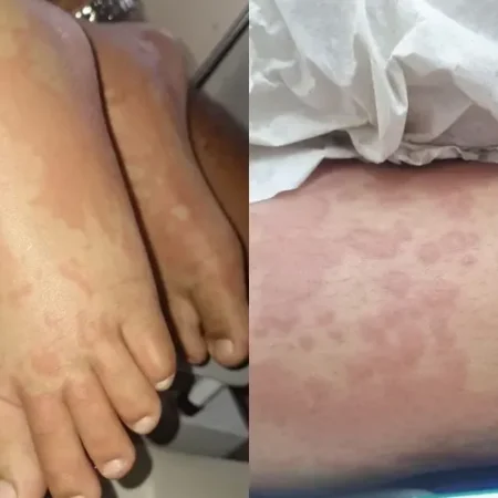 CRIANÇA É INTERNADA POR SUSPEITA DE CONTAMINAÇÃO APÓS USO DE DETERGENTE