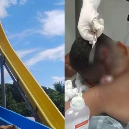 CRIANÇA SOFRE FERIMENTO NA CABEÇA EM TOBOGÃ DE PARQUE AQUÁTICO E PAI DENUNCIA TENTATIVA DE SUBORNO PARA ‘ABAFAR’ CASO