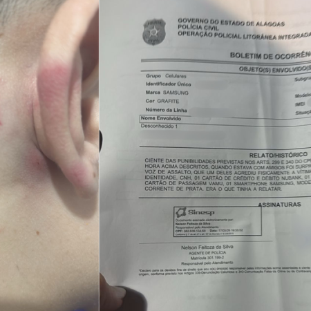CASAL DE AMIGOS É ROUBADO E AGREDIDO DURANTE ARRASTÃO
