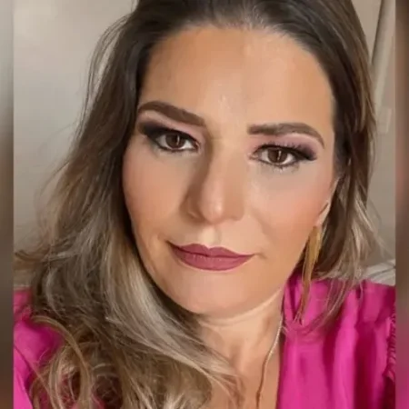 EMPRESÁRIA MORRE APÓS PASSAR POR 3 INTERVENÇÕES ESTÉTICAS NO MESMO DIA