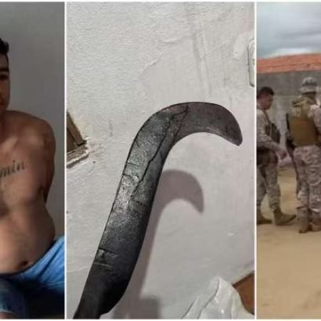 MULHER TEM MÃO DECEPADA POR FOICE APÓS SER AGREDIDA PELO EX-NAMORADO