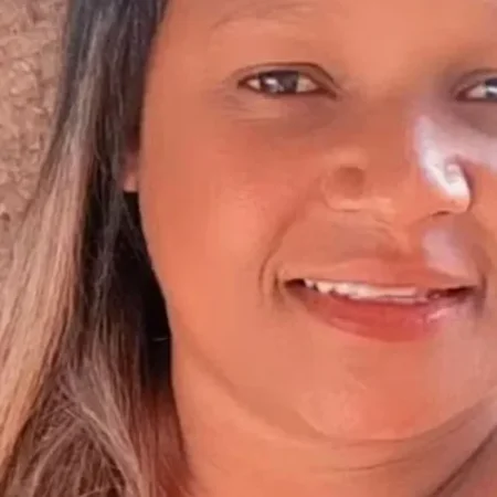 MORRE MULHER QUE TEVE CORPO QUEIMADO PELO EX-COMPANHEIRO