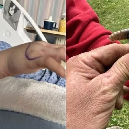 PAI CONFUNDE CASCAVEL COM ANIMAL INOFENSIVO E FILHO É PICADO DURANTE JARDINAGEM