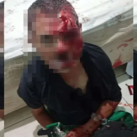 TORTURADORA MASCARADA DESFIGUROU VÍTIMA COM FACA E ISQUEIRO